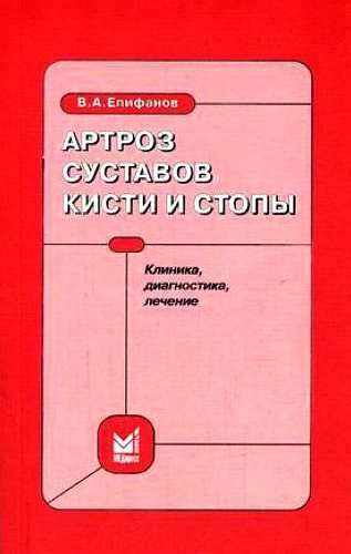 Артроз суставов кисти и стопы: клиника, диагностика, лечение